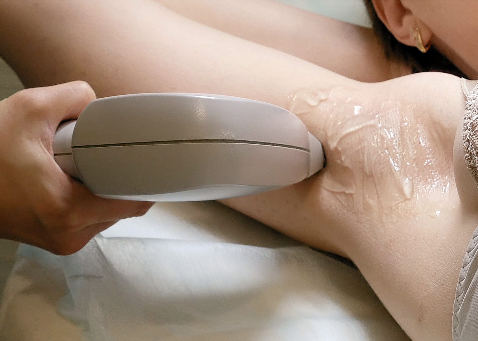 Clinia Doctores Cuevas Depilacion por laser 4